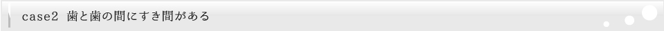 すきっ歯・歯と歯の間にすき間がある