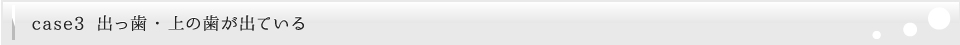 出っ歯・上の歯が出ている